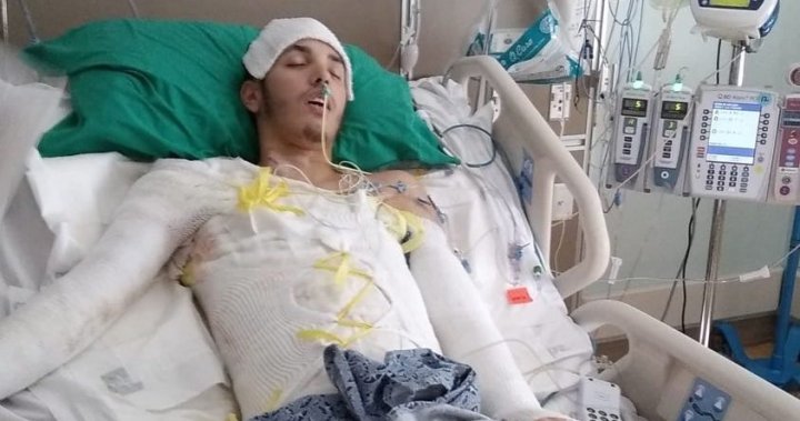 Florida man ‘cooked alive’ after police use stun gun in gas station arrest, lawyers say – National
